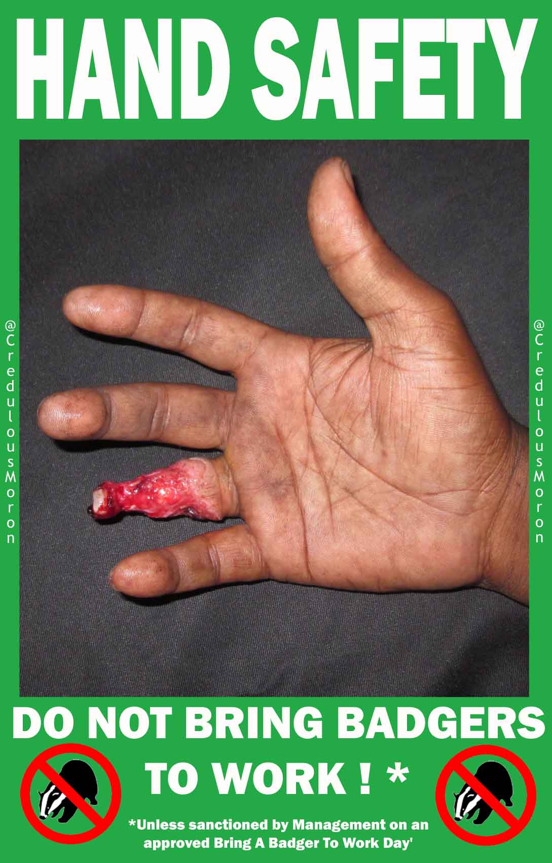 HAND SAFETY ! - The Poke